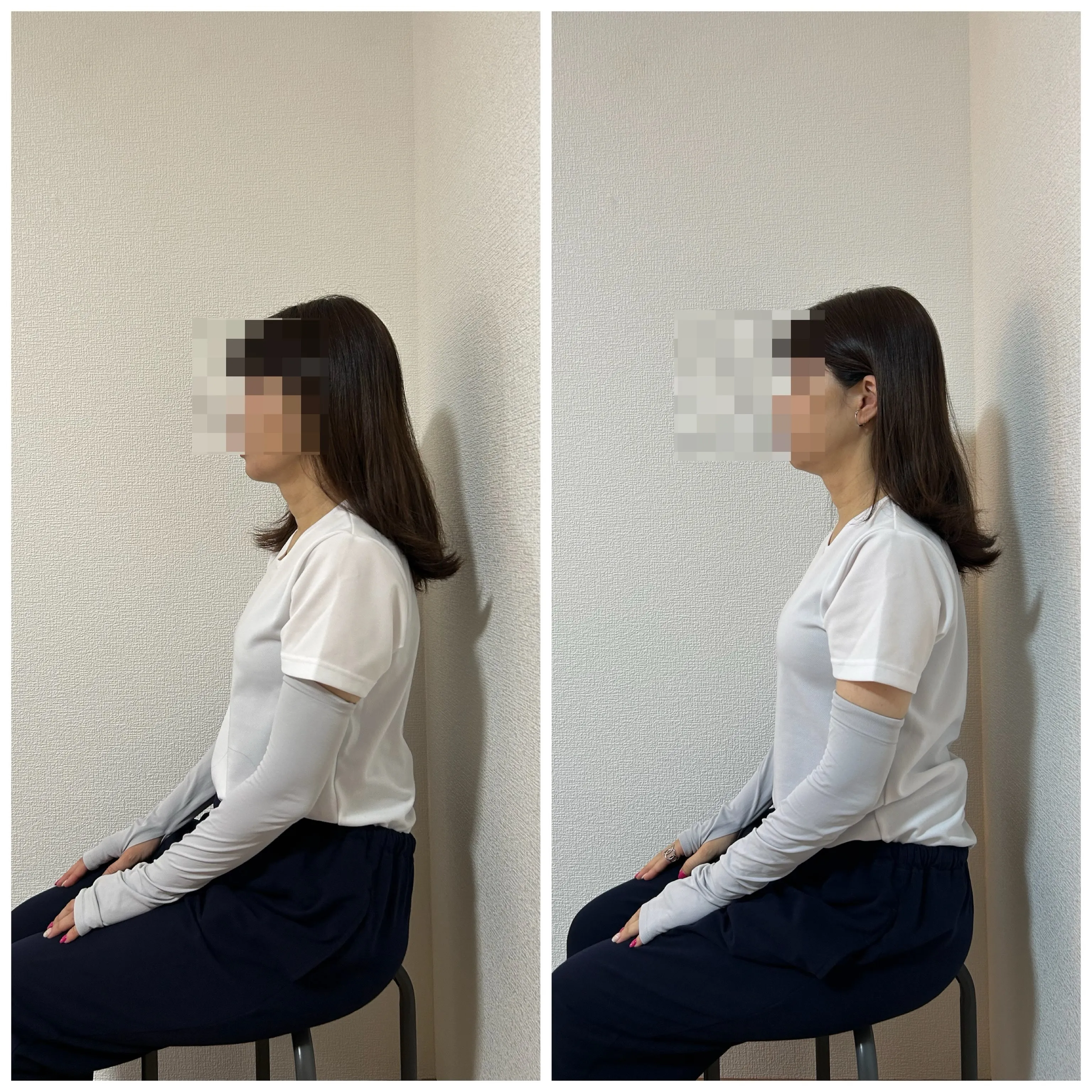 シナプス療法の施術です。