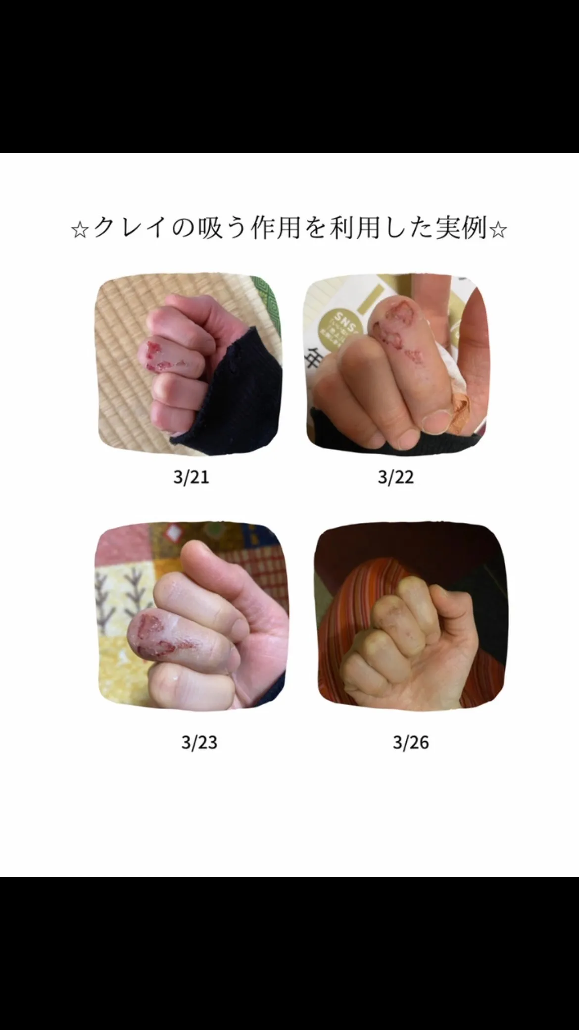 クレイってすごいんだー👍